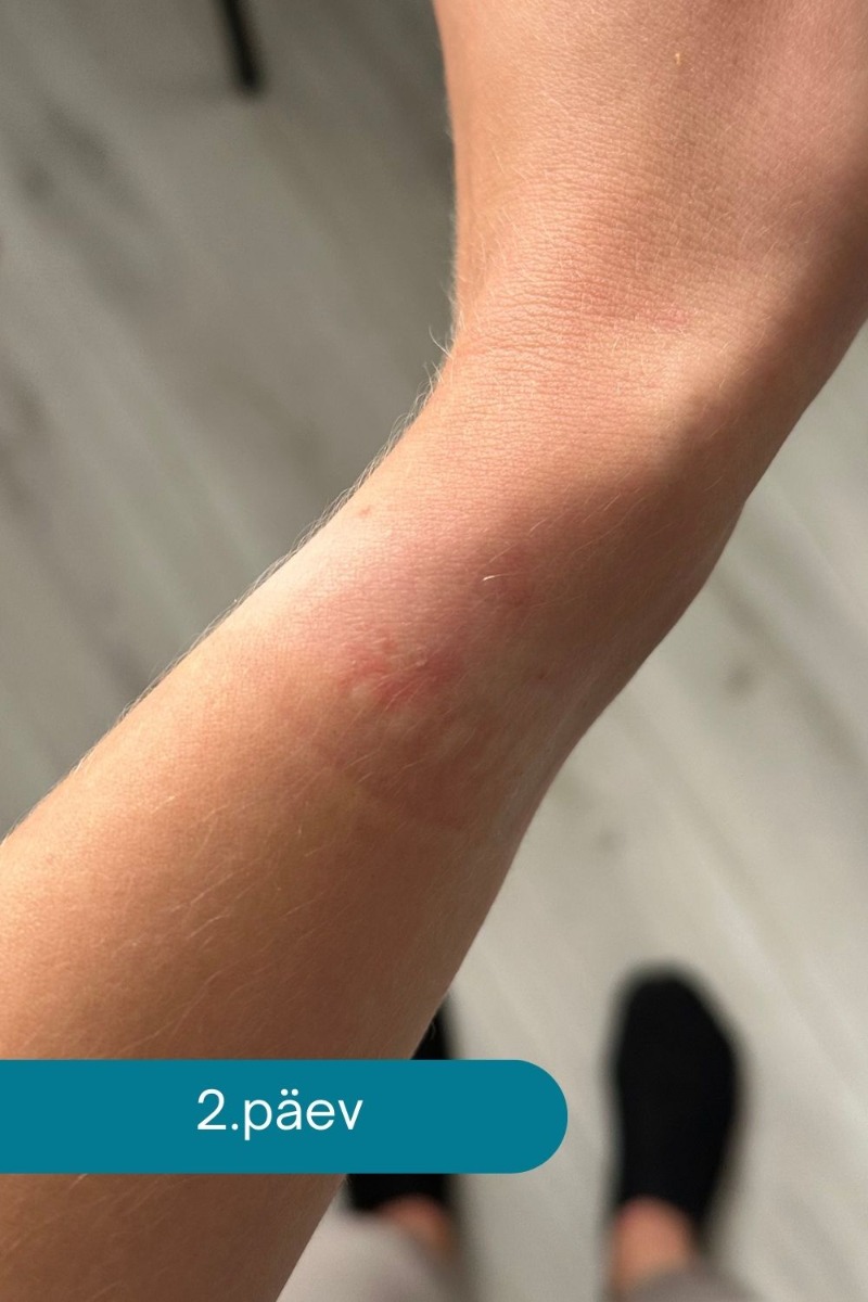 Ovelle Calamine Cream odos raminimui