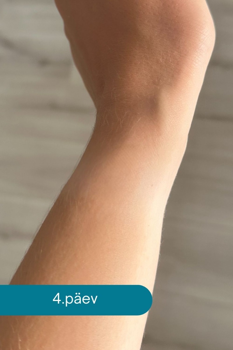 Ovelle Calamine Cream odos sudirginimui mažinti