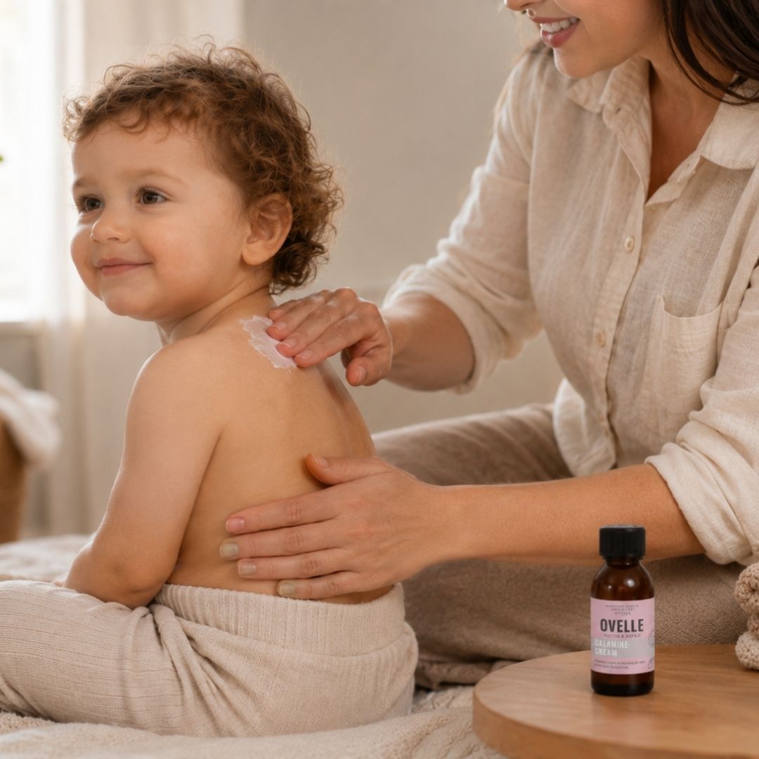 Ovelle Calamine Cream naudojimas vėjaraupių metu ant niežtinčios odos